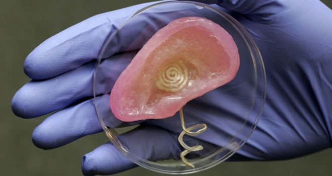 Científicos crean una oreja biónica usando una impresora 3D
